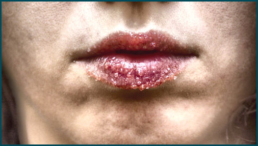 Exfoliar labios con vaselina